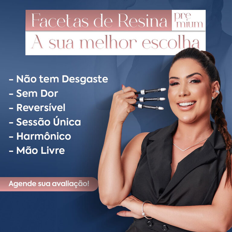 Facetas de Resina