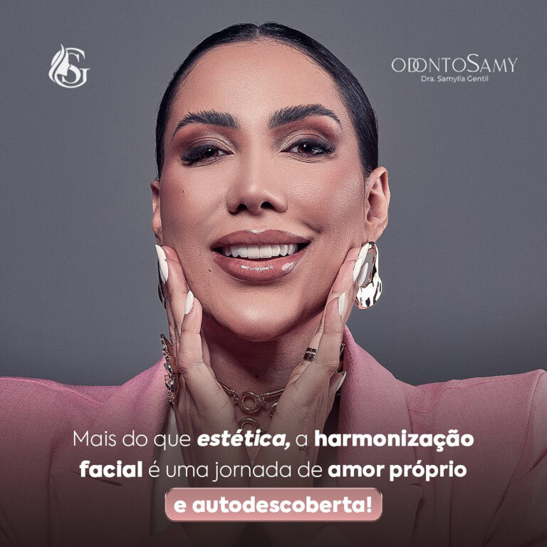 Harmonização facial