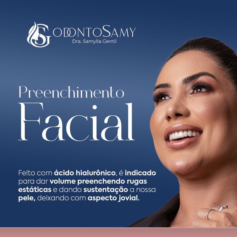 Preenchimento facial